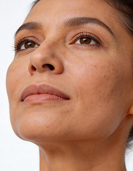 Pigmentation & Dark Spots