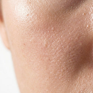 Skin Barrier & Chronic Dryness