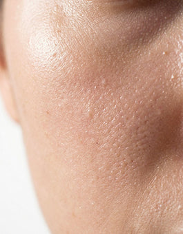 Skin Barrier & Chronic Dryness